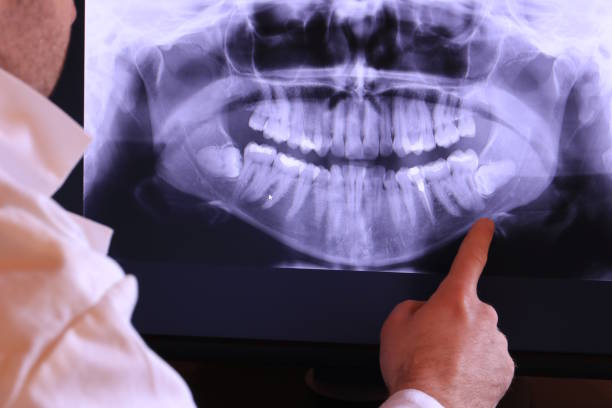 Best Knocked-Out Tooth Emergency  in Williamsburg, KY